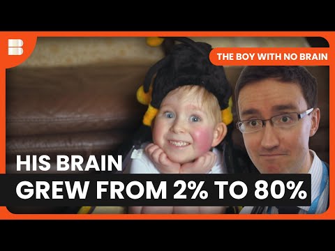 His Brain Grew 78% | The Boy With No Brain | Medical Documentary