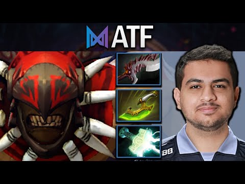 TI13 - Bloodseeker Dota 2 Gameplay Nigma.ATF with 19 Kills - Berlin Major