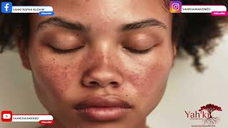 She Said It Was Lupus, but what about her THYROID 