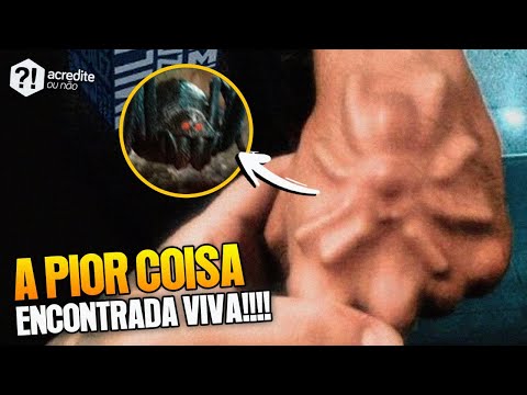 5 COISAS QUE JÁ FORAM ENCONTRADAS VIVENDO DENTRO DE PESSOAS