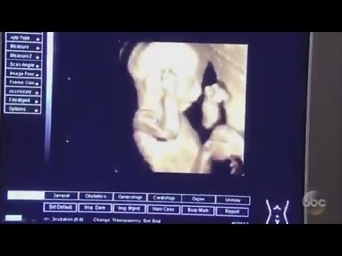 2-27-17 GH Promo - Daddy is Going to Come for Us