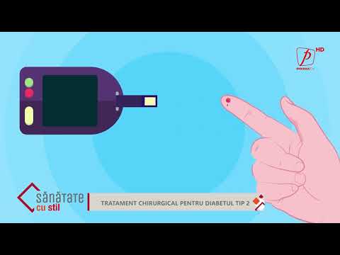 Operatia de diabet tip 2, Turcia, prin Ensar Duman.  Sanatate cu stil, Prima TV