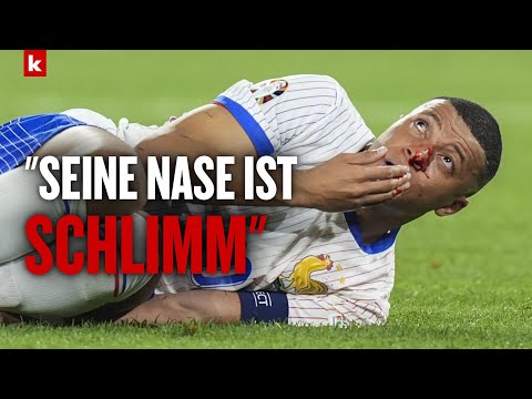 Deschamps über Mbappé: "Es geht ihm nicht gut" I Österreich - Frankreich 0:1