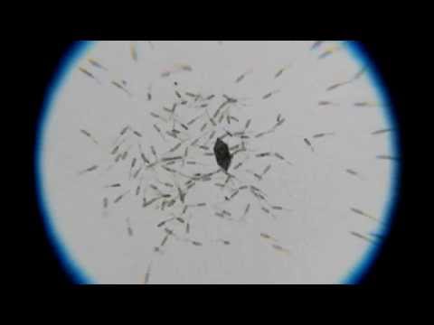 Chemotaxis: Bacteria attracted by a sugar crystal