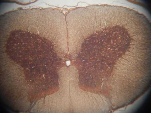 gray & white matter in human spinal cord