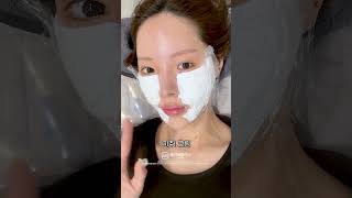 리쥬란힐러 후기