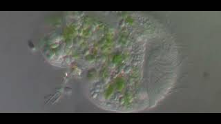 Download lagu Perispira ovum Stein 1859 brackish cove 5.3 o/oo salinity, 1000x, 80 um long mp3 Download lagu Perispira ovum Stein 1859 brackish cove 5.3 o/oo salinity, 1000x, 80 um long mp3