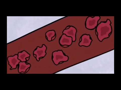 Детектив Войд: Scp 3017 - Он самый опасный? Старое/удалённое видео Детектива Войда