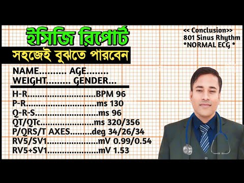 ECG report is so easy. HOW TO READ AN ECG REPORT. ECG INTERPRETARION. ECG REPORT IN BANGLA