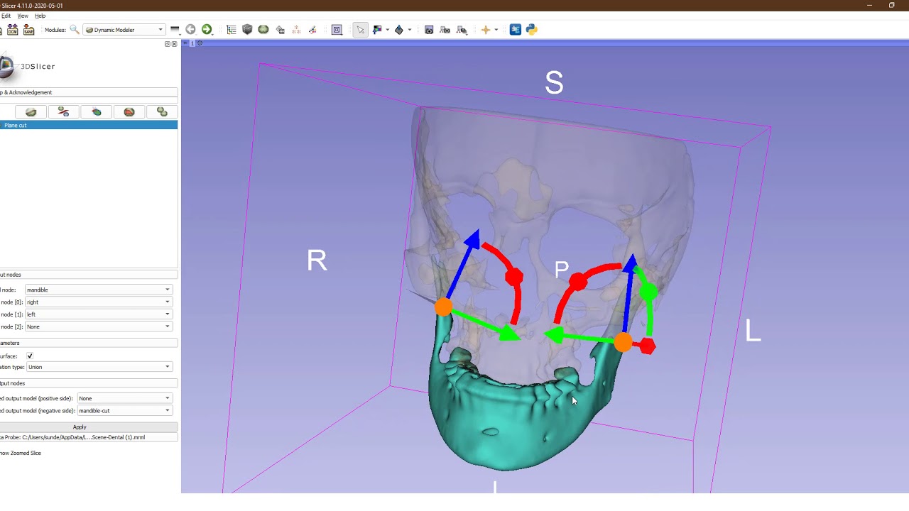 Unchanged Markup Position and Sequences - Support - 3D Slicer Community