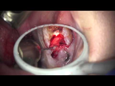 download lagu mp3 mp4 Gingiburs, download lagu Gingiburs gratis, unduh video klip Download Gingiburs Mp3 dan Mp4 Viral Gratis