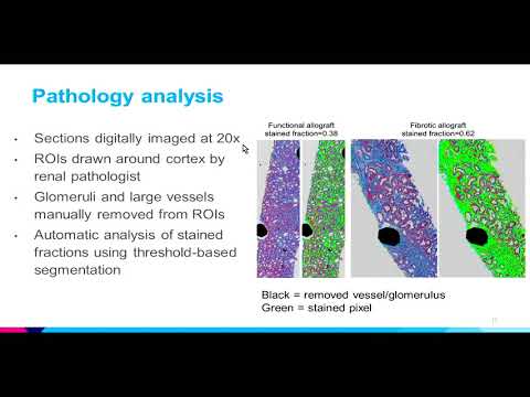 8th Annual TMII Symposium – 2018 – Session IV – Cancer & Body Imaging – Octavia Bane, PhD