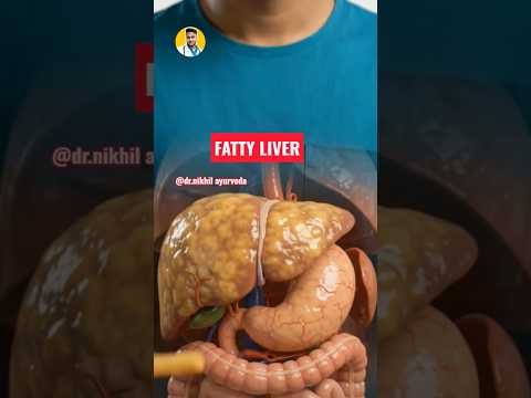 Reversing Grade 1 & 2 Fatty Liver Clinically