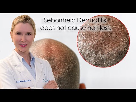 Seborrheic Dermatitis and Hair Loss