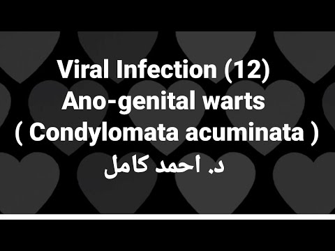 Szifilitikus condyloma, A betegség kialakulásának stádiumai
