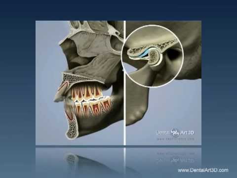 DentalArt3D. Introduction to Neuromuscular Dentistry