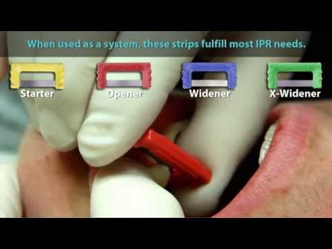 Crowded Teeth - ContacEZ IPR Strip System
