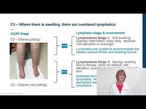 a thrombophlebitis és a varikózis kezelése a lábakon)