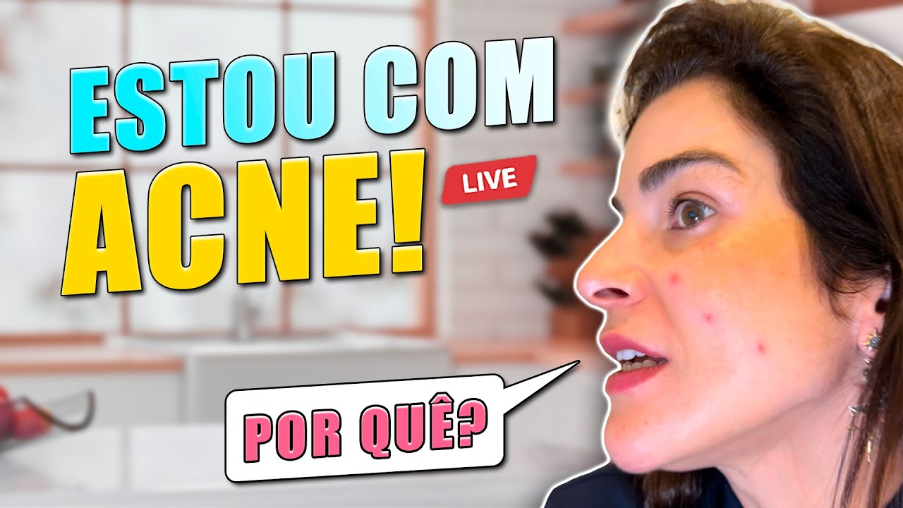 Porquê Temos ACNE (Espinhas no Rosto ) mesmo Adultos??