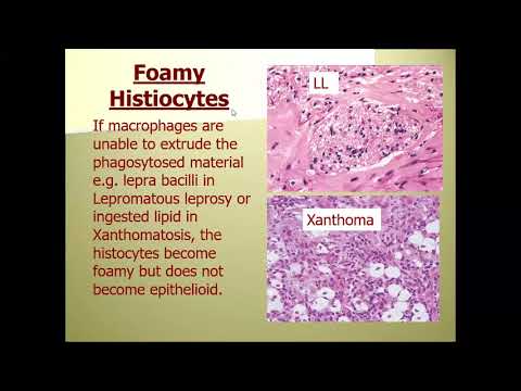 Lecture-8: Dermatopathology; Granulomatous inflammation