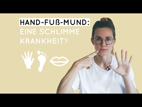 Hand, Foot, and Mouth Disease: How Severe is It? What to Do? | ASK DR. NELE!