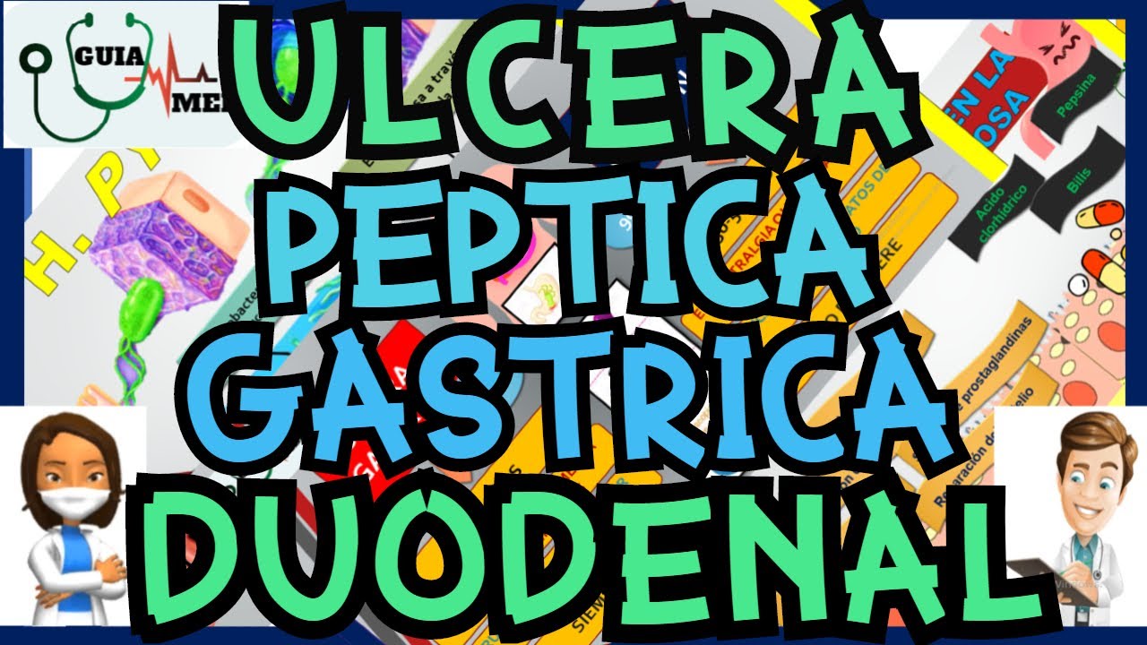 ÚLCERA PÉPTICA, GÁSTRICA Y DUODENAL | GuiaMed