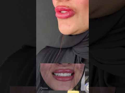 مصر – فنيرز