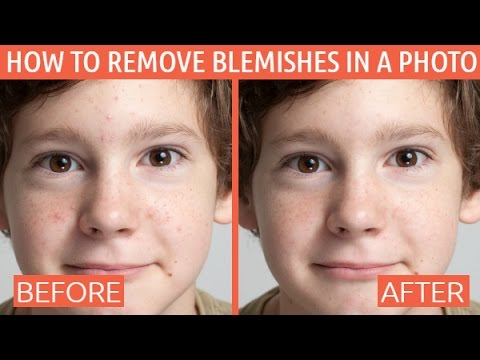 How to Remove Skin Blemishes, Spots, and Other Imperfections from Photos Video