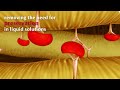 Edwards INSPIRIS RESILIA Aortic Valve