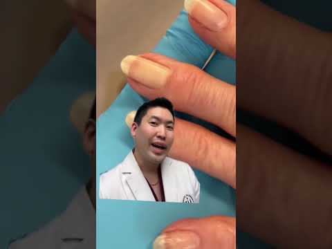 #shorts Nail changes to Suggest Anemia