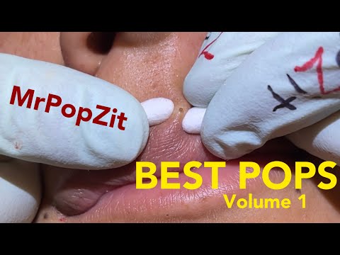 Top Pops volume 1. All kinds of pops from MrPopZit. Some new, some old.