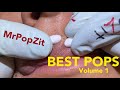 Top Pops volume 1. All kinds of pops from MrPopZit. Some new, some old.