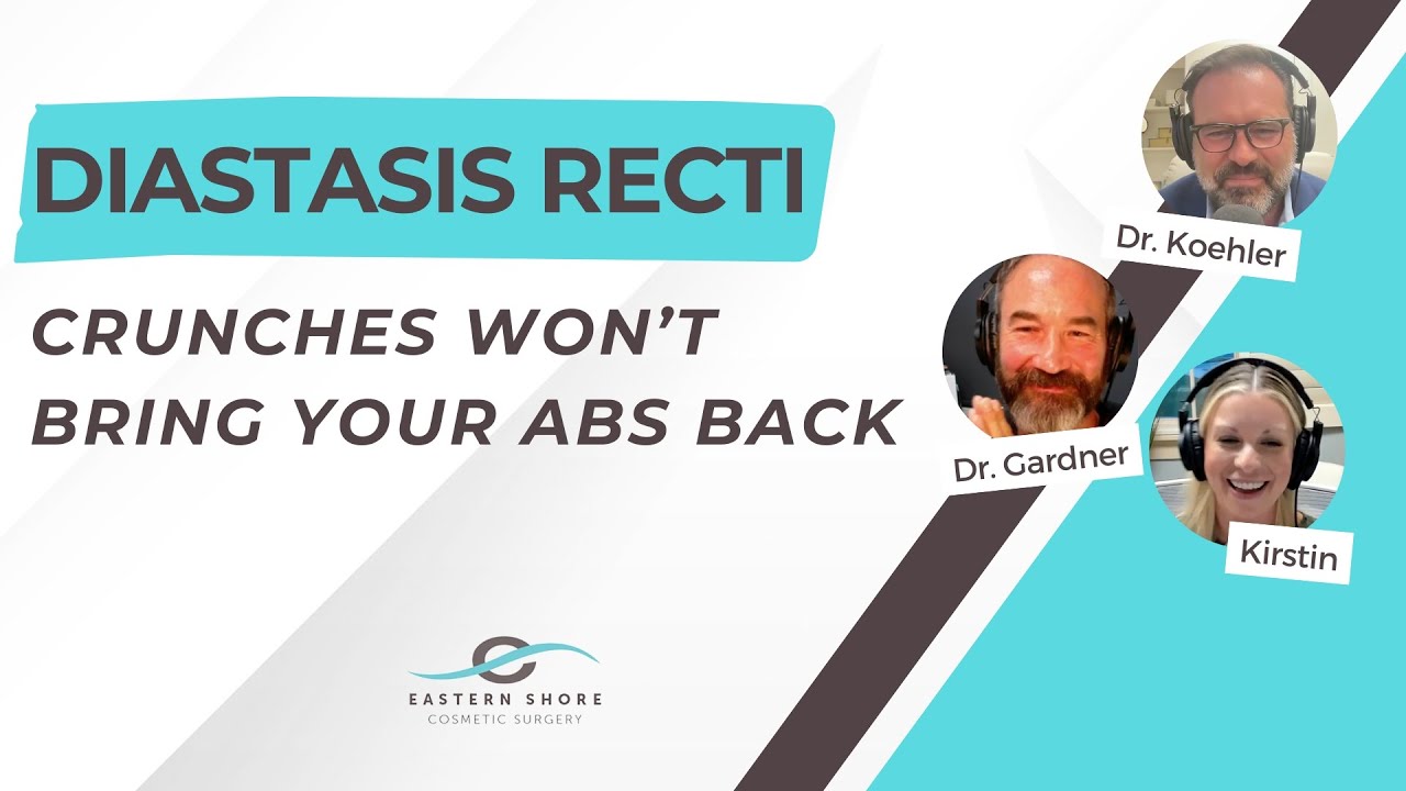 Diastasis Recti: When No Amount of Crunches Will Bring Your Abs Back