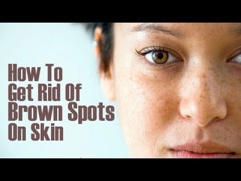 How To Get Rid Of Freckles On Face Permanently.
