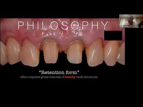 Save the Enamel: Utilizing CAD/CAM for Partial Coverage Restorations with Dr. Anthony Mennito