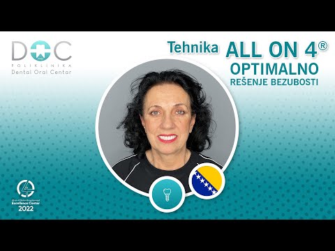 All On 4 koncept - optimalno rešenje bezubosti i savršen novi osmeh za samo 1 dan