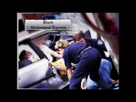 How to Perform the eFAST or FAST Scan (Extended Focused Assessment with Sonography for Trauma)