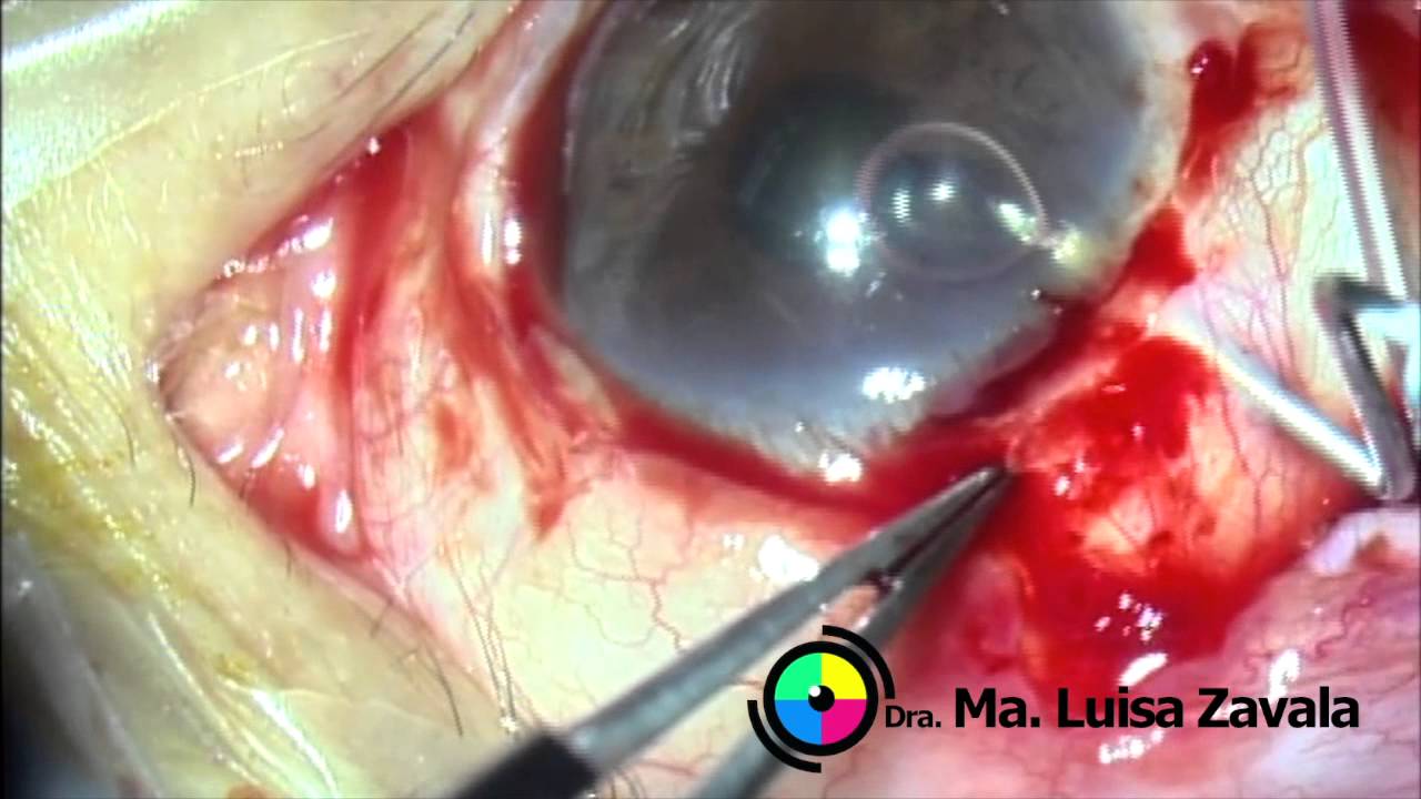 María Luisa Zavala Aznar-25