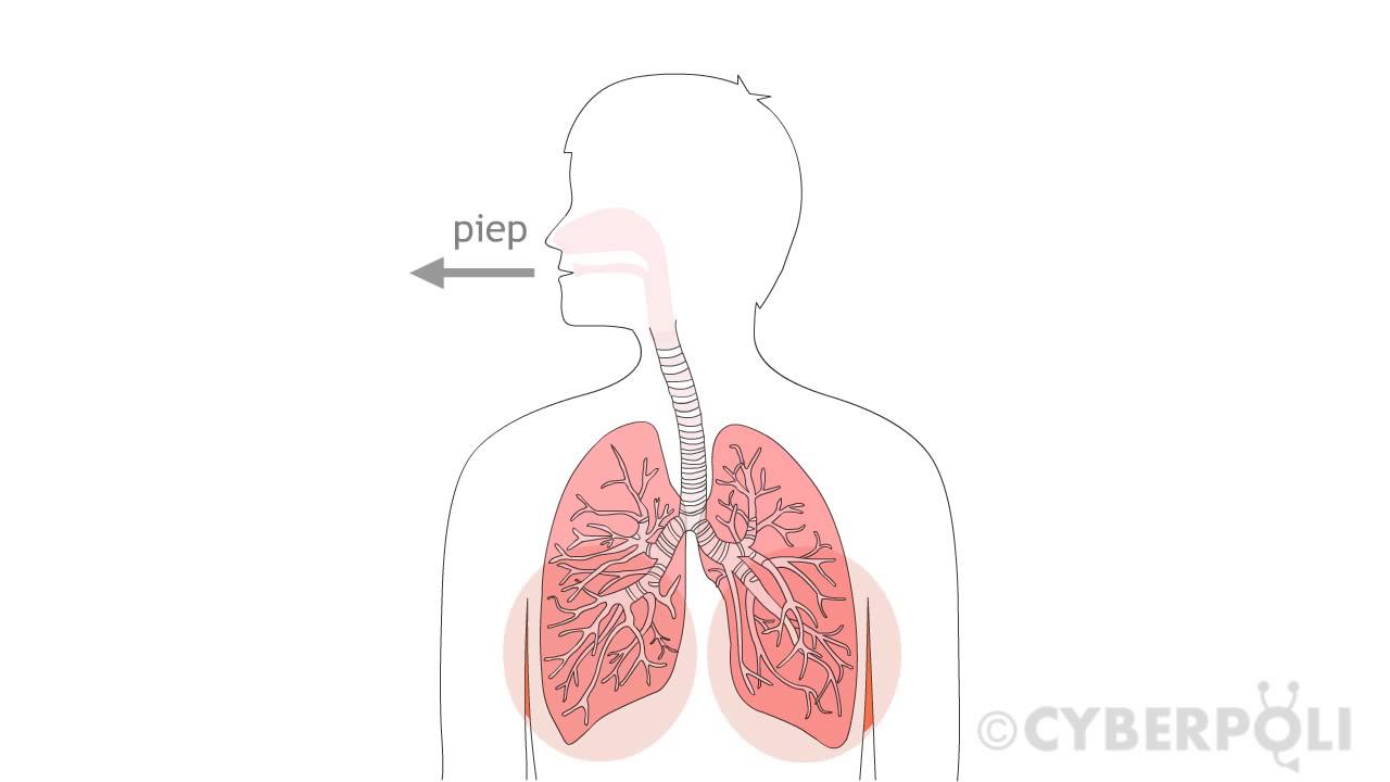 Astma - Wat is piepen of wheezing? | Cyberpoli Astma - Wat Is Piepen Of Wheezing? | Cyberpoli
