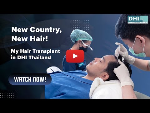 New Country, New Hair My Hair Transplant in DHI Thailand I DHI Original Technique