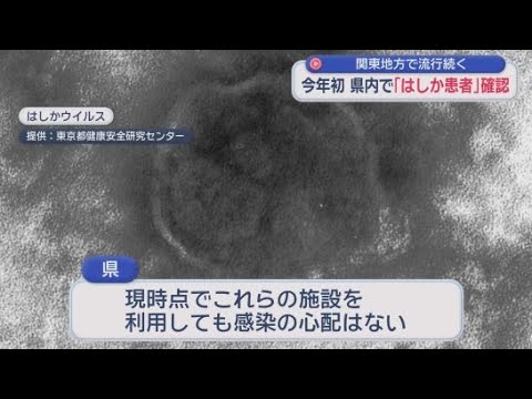 YouTube Video 今年県内で初めて“はしか”患者を確認　関東中心に流行　静岡県　