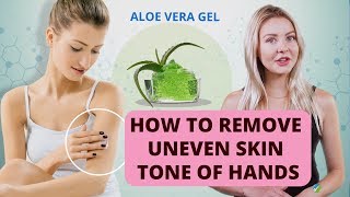 How To Remove Uneven Skin Tone of Hands?