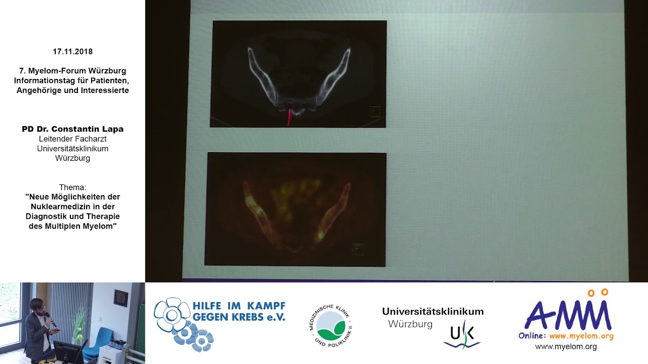 Nuklearmedizin i. d. Diagnostik & Therapie des Multiplen Myeloms