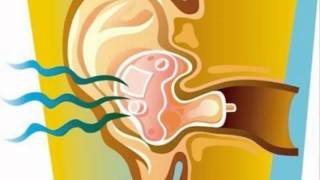 Stop Ringing In Ears - How To Stop Your Tinnitus Using Natural Treatment