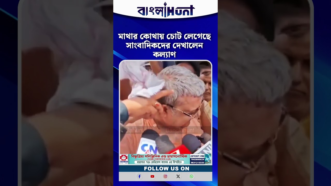 মাথার কোথায় চোট লেগেছে সাংবাদিকদের দেখালেন কল্যাণ | Kalyan banerjee