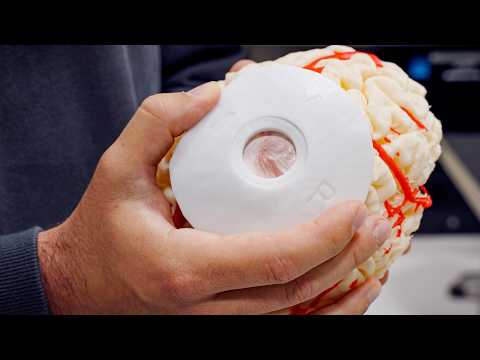 Video Thumbnail: Our First Transdural Procedure | Neuralink