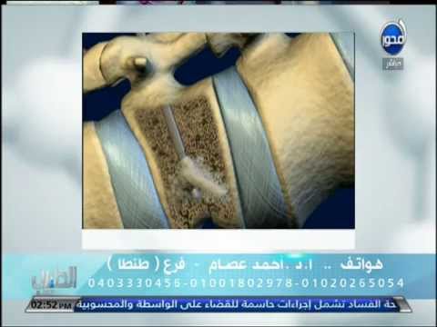 أحدث وأهم طرق علاج آلام العمود الفقري بدون جراحة وبدون ألم