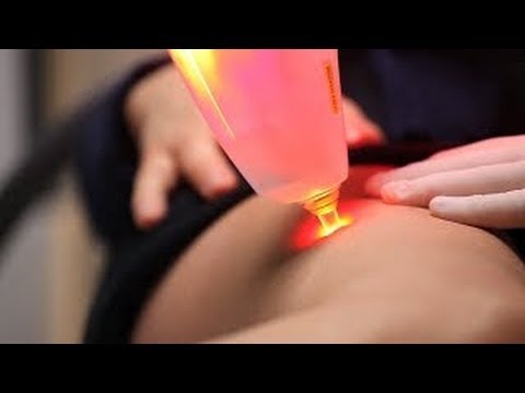 Ginnastica sulla Norbekovu colonna cervicale Distorsione alla caviglia come il tumore continua