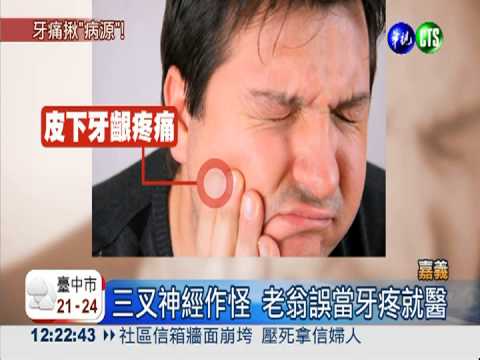 三叉神經痛誤當牙疼 老翁白拔牙