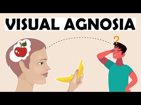 What is Visual Agnosia? 10 Things You Need to Understand